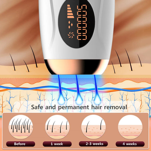 Laserport Epilator